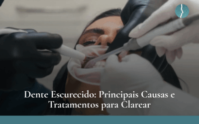Dente Escurecido: Principais Causas e Tratamentos para Clarear
