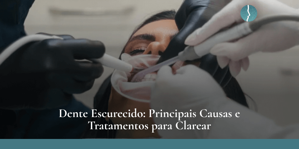 Dente Escurecido: Principais Causas e Tratamentos para Clarear