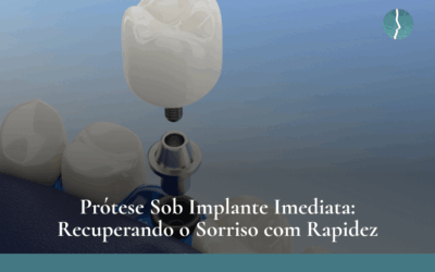 Prótese Sob Implante Imediata Recuperando o Sorriso com Rapidez