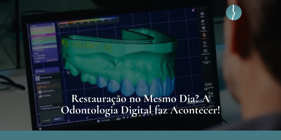 Restauração no Mesmo Dia? A Odontologia Digital faz Acontecer!  