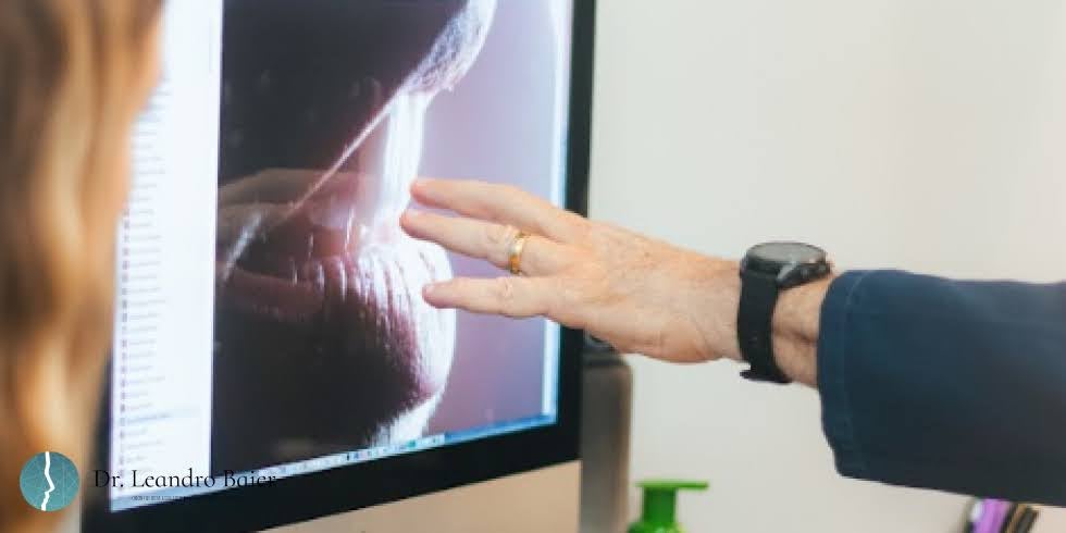 Dr. Leandro Baier | Clínica de Odontologia Estética em Blumenau, SC Dentes se Desgastando? Entenda os Sintomas Que Passam Despercebidos