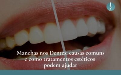 Dr. Leandro Baier | Clínica de Odontologia Estética em Blumenau, SC Manchas nos dentes: causas comuns e como tratamentos estéticos podem ajudar