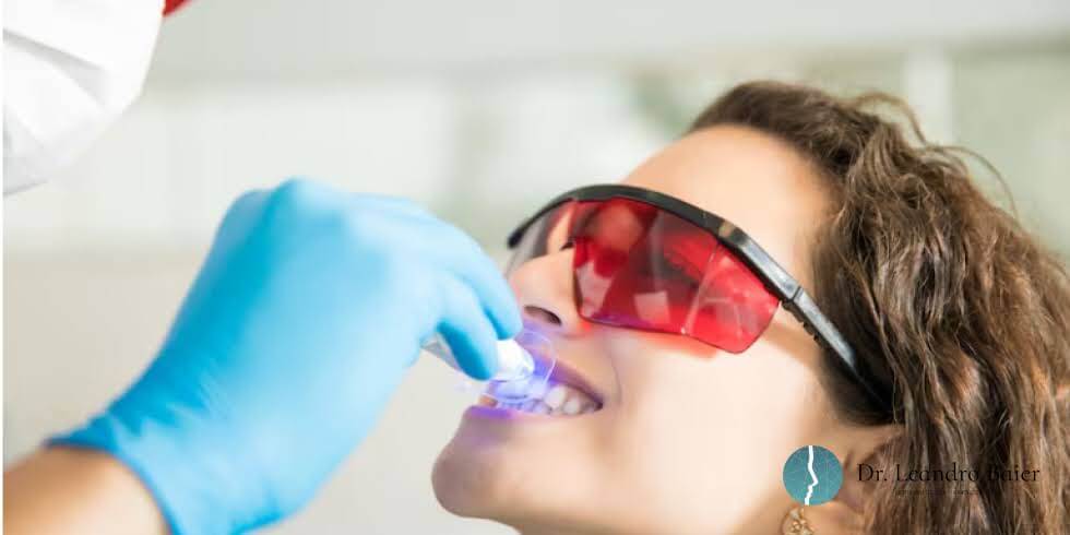 Dr. Leandro Baier | Clínica de Odontologia Estética em Blumenau, SC Manchas nos dentes: causas comuns e como tratamentos estéticos podem ajudar