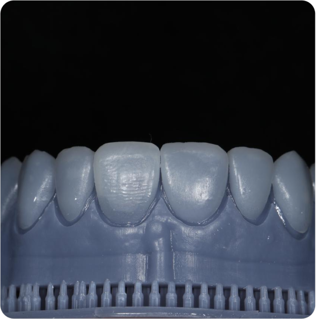 Dr. Leandro Baier | Clínica de Odontologia Estética em Blumenau, SC