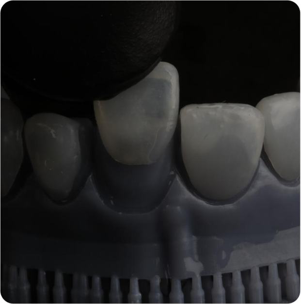 Dr. Leandro Baier | Clínica de Odontologia Estética em Blumenau, SC