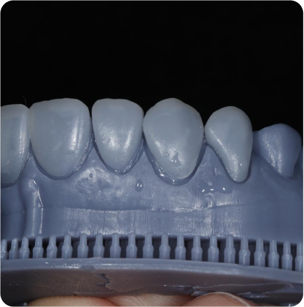 Dr. Leandro Baier | Clínica de Odontologia Estética em Blumenau, SC