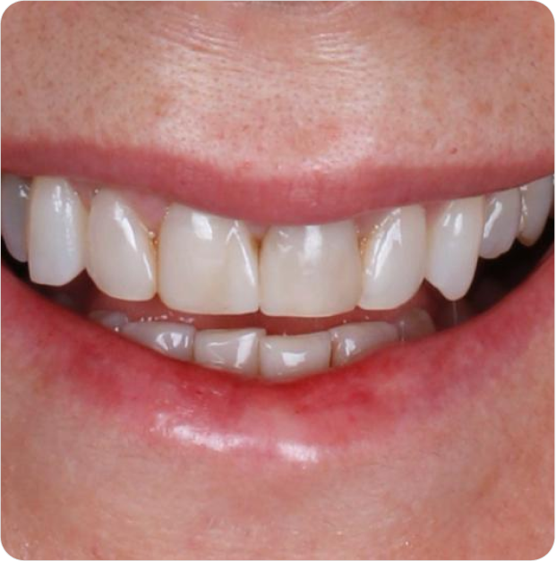 Dr. Leandro Baier | Clínica de Odontologia Estética em Blumenau, SC