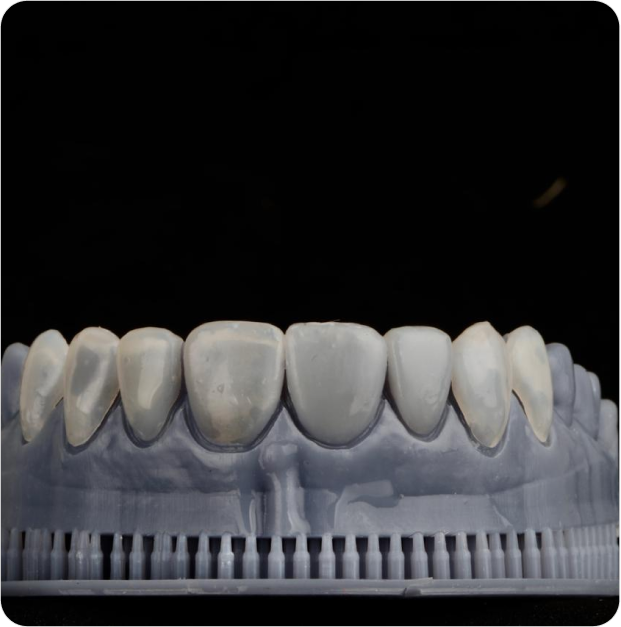 Dr. Leandro Baier | Clínica de Odontologia Estética em Blumenau, SC