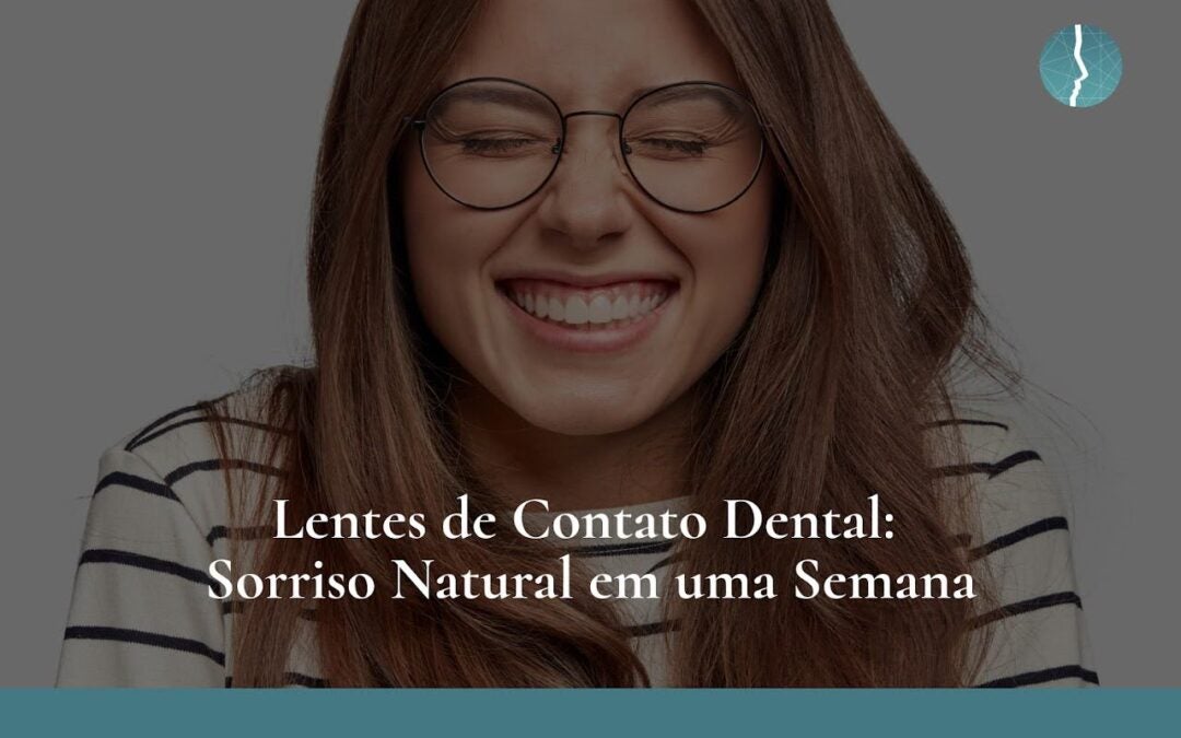 Lentes de Contato Dental: Sorriso Natural em uma Semana 