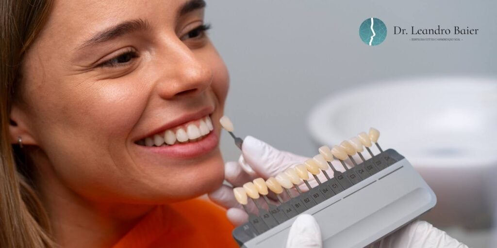 Lentes de Contato Dental: Sorriso Natural em uma Semana 
