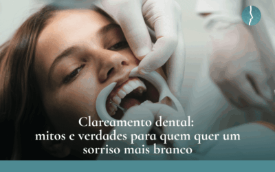 Clareamento dental: mitos e verdades para quem quer um sorriso mais branco