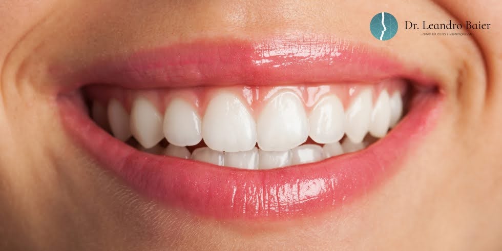 Dr. Leandro Baier | Clínica de Odontologia Estética em Blumenau, SC Dr. Leandro Baier | Clínica de Odontologia Estética em Blumenau, SC