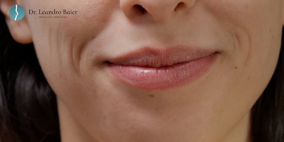 Dr. Leandro Baier | Clínica de Odontologia Estética em Blumenau, SC Dr. Leandro Baier | Clínica de Odontologia Estética em Blumenau, SC