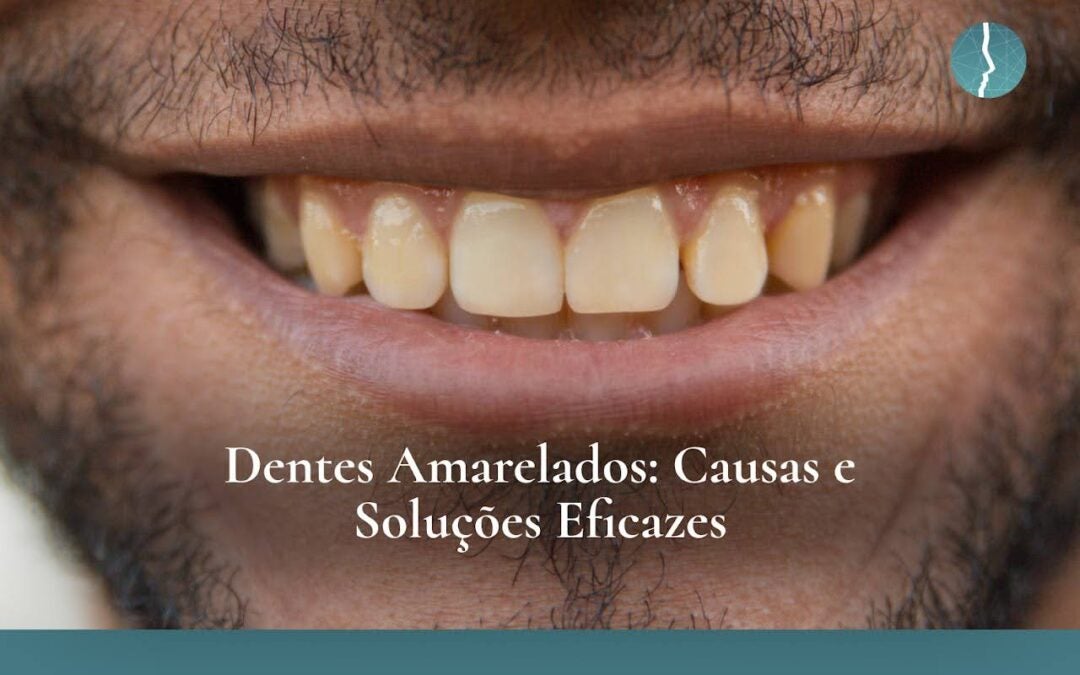 Dentes Amarelados: Causas e Soluções Eficazes