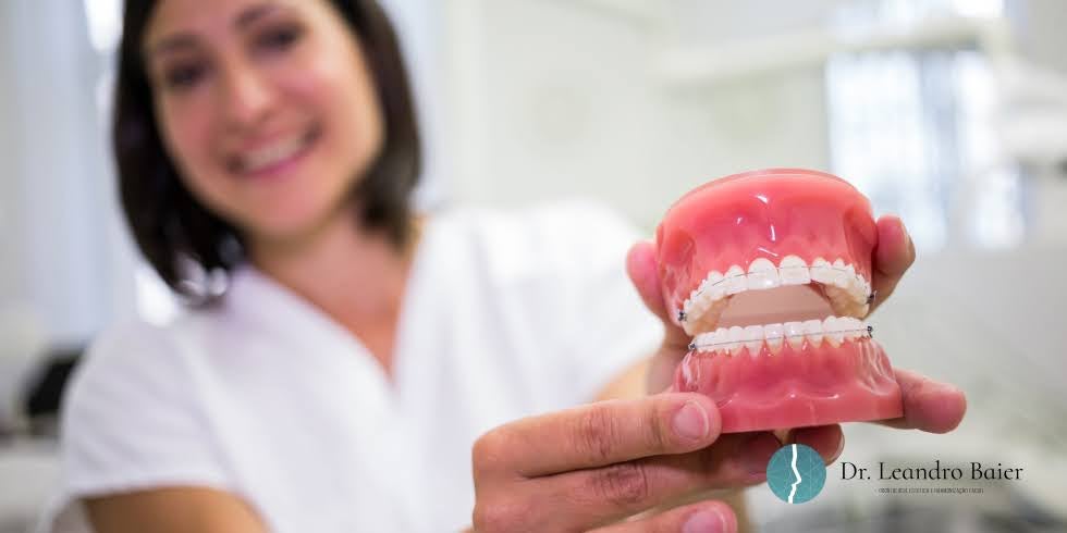 Reabilitação Oral Full: O Que É e Quem Precisa Deste Tratamento