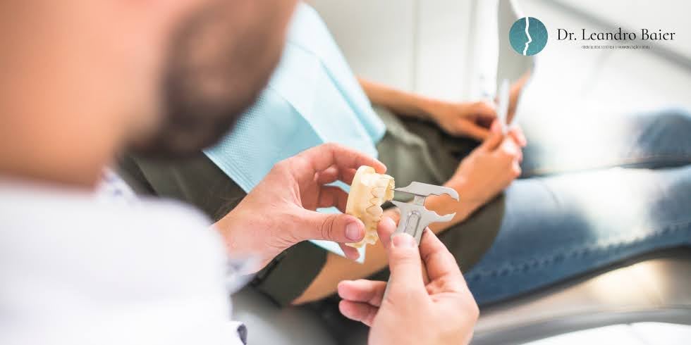 Reabilitação Oral Full: O Que É e Quem Precisa Deste Tratamento