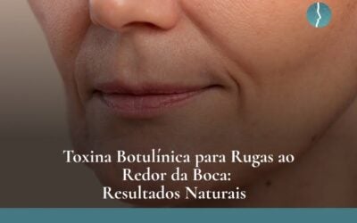 Dr. Leandro Baier | Clínica de Odontologia Estética em Blumenau, SC Toxina Botulínica para Rugas ao Redor da Boca: Resultados Naturais