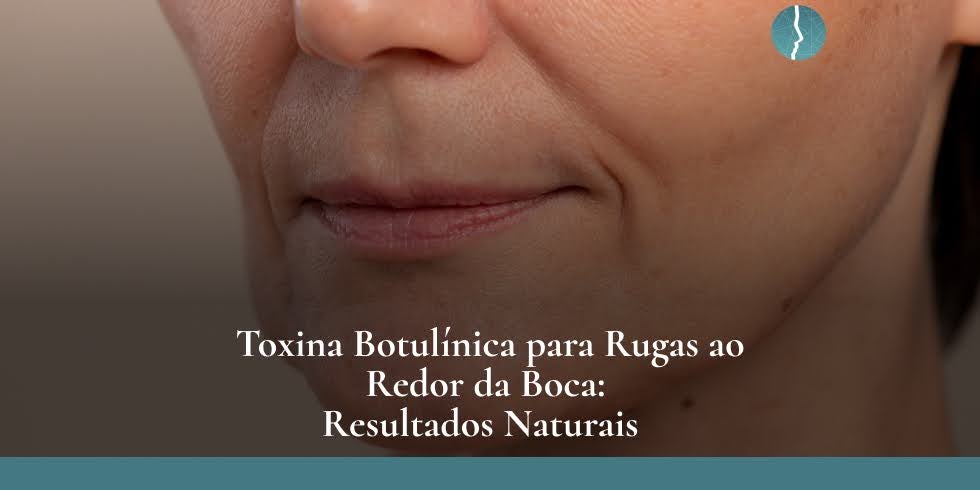 Toxina Botulínica para Rugas ao Redor da Boca: Resultados Naturais