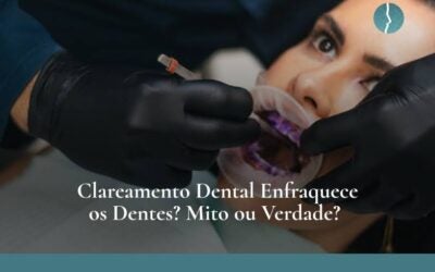 Clareamento dental enfraquece os dentes? Mito ou verdade?