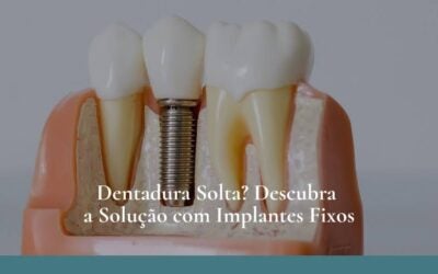 Dentadura Solta? Descubra a Solução com Implantes Fixos