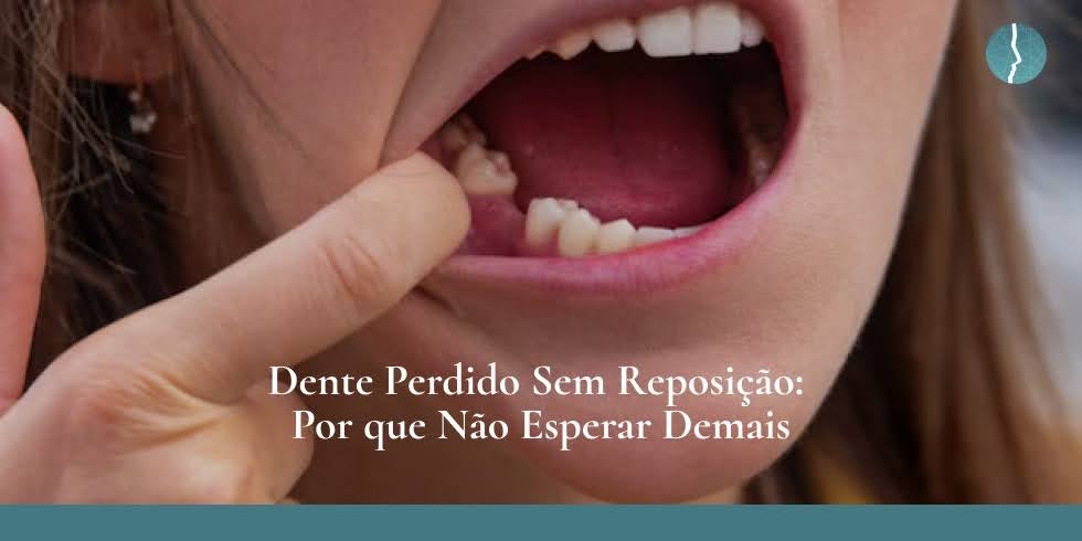 Dente Perdido Sem Reposição: Por Que Não Esperar Demais