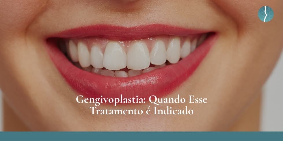 Gengivoplastia em Blumenau: Quando Esse Tratamento é Indicado