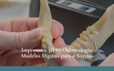 Dr. Leandro Baier | Clínica de Odontologia Estética em Blumenau, SC Impressora 3D na Odontologia: Modelos Digitais para o Sorriso